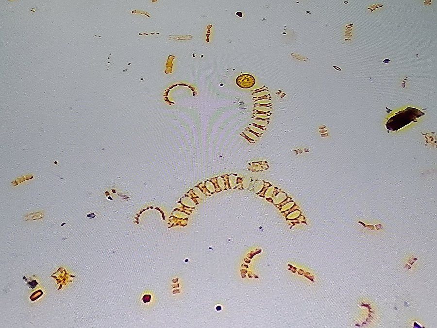chain diatoms in a plankton sample