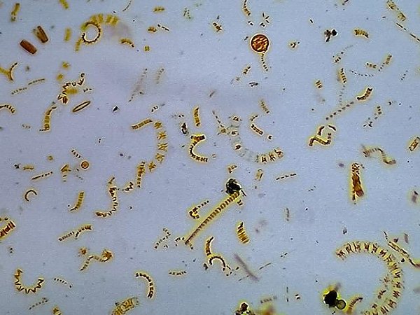 microscopic algae called phytoplankton