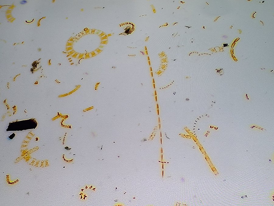 assortment of phytoplankton, including pseudo-nitzschia which is stick-shaped